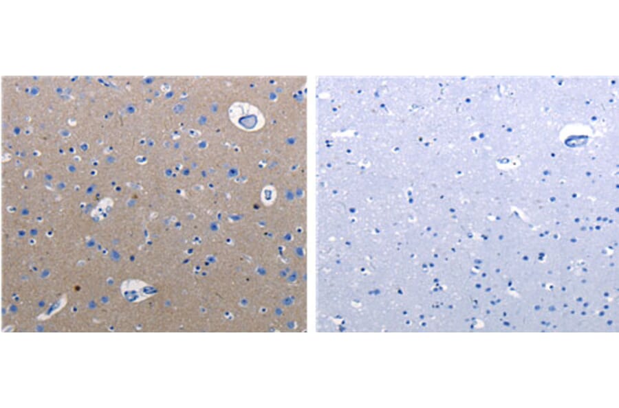 RAB3c Antibody from Signalway Antibody (31148) - Antibodies.com