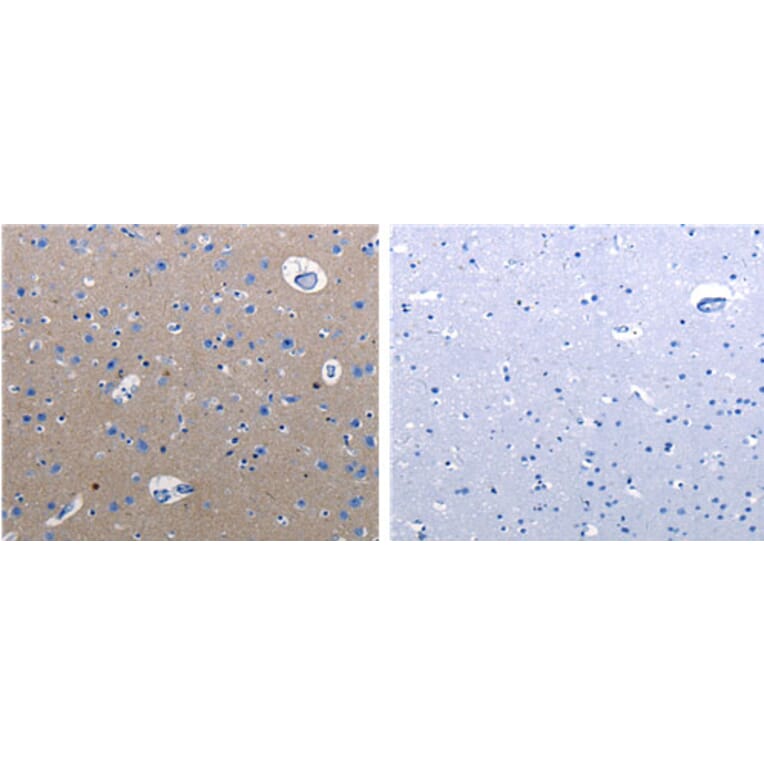 RAB3c Antibody from Signalway Antibody (31148) - Antibodies.com