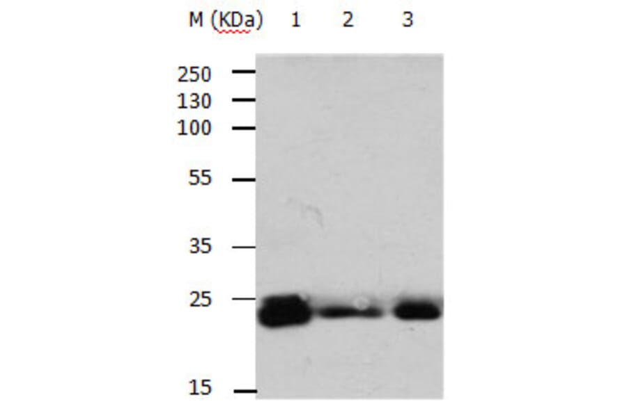 RAB6A Antibody from Signalway Antibody (31154) - Antibodies.com