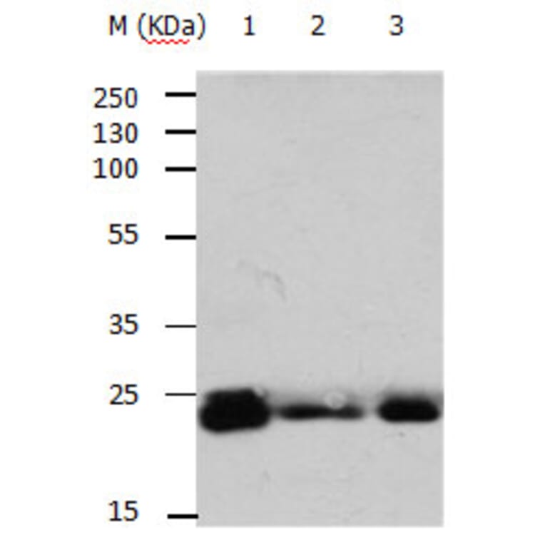 RAB6A Antibody from Signalway Antibody (31154) - Antibodies.com
