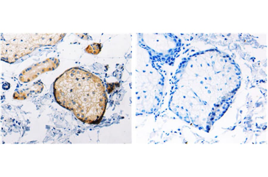RAB6A Antibody from Signalway Antibody (31154) - Antibodies.com