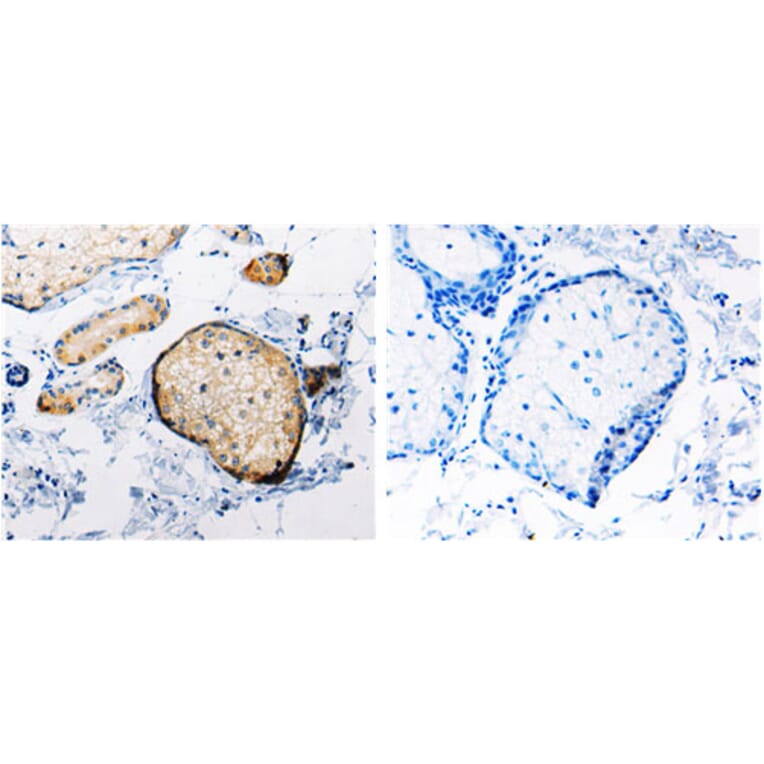 RAB6A Antibody from Signalway Antibody (31154) - Antibodies.com