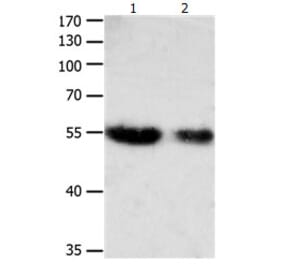 CBFA1 Antibody from Signalway Antibody (31165) - Antibodies.com