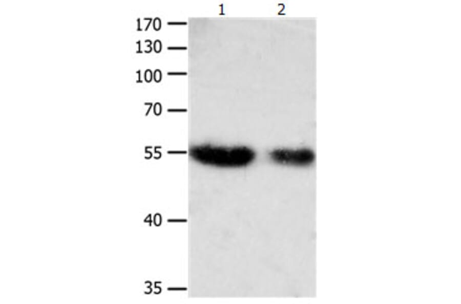 CBFA1 Antibody from Signalway Antibody (31165) - Antibodies.com