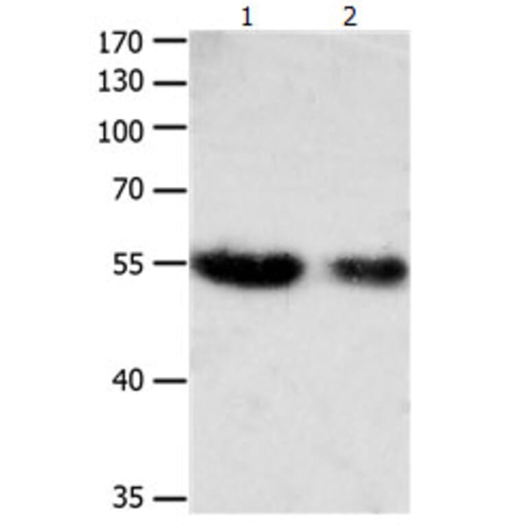 CBFA1 Antibody from Signalway Antibody (31165) - Antibodies.com