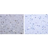 CBFA1 Antibody from Signalway Antibody (31165) - Antibodies.com