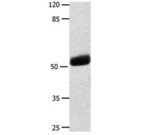 KRT16 Antibody from Signalway Antibody (31172) - Antibodies.com