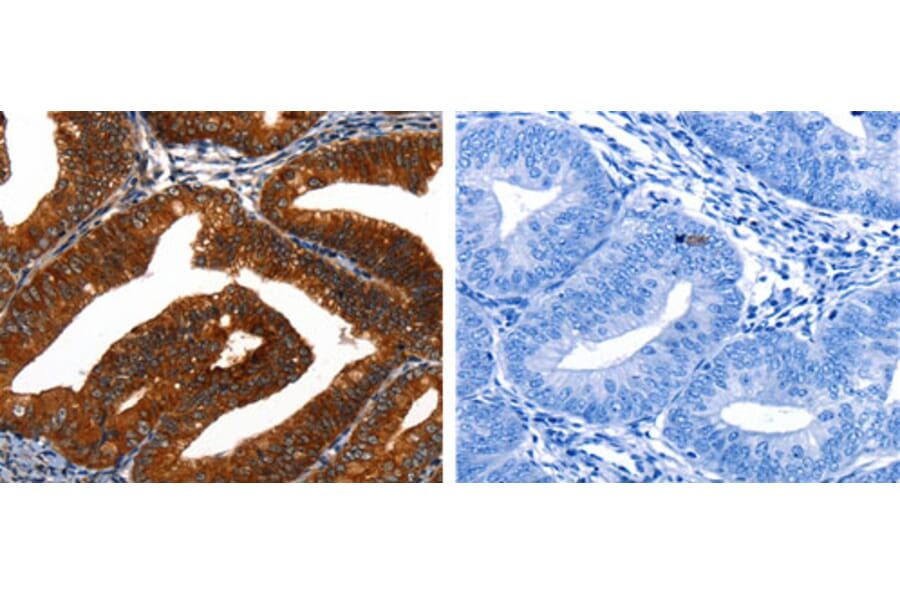 KRT16 Antibody from Signalway Antibody (31172) - Antibodies.com