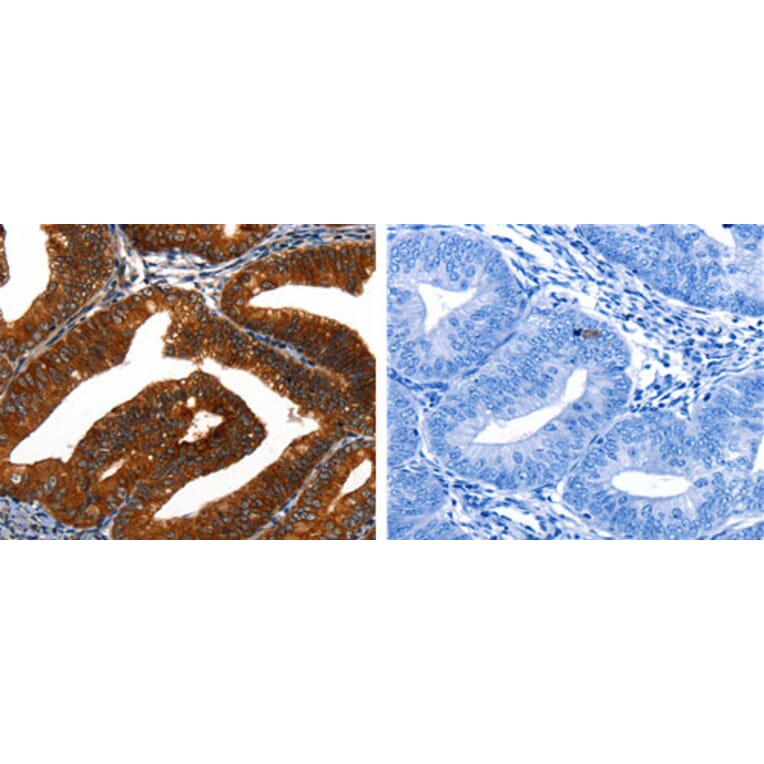 KRT16 Antibody from Signalway Antibody (31172) - Antibodies.com