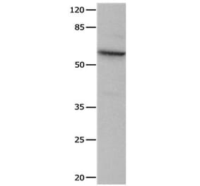 CRMP1 Antibody from Signalway Antibody (31173) - Antibodies.com