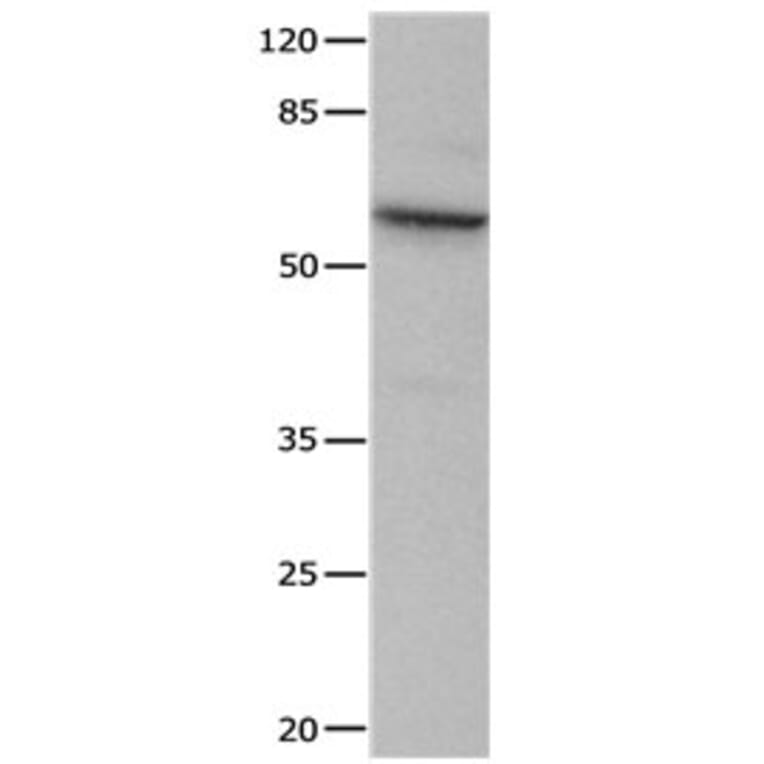 CRMP1 Antibody from Signalway Antibody (31173) - Antibodies.com
