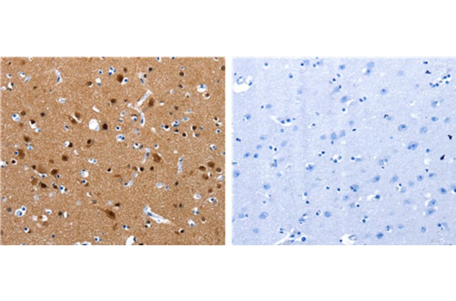 CRMP1 Antibody from Signalway Antibody (31173) - Antibodies.com