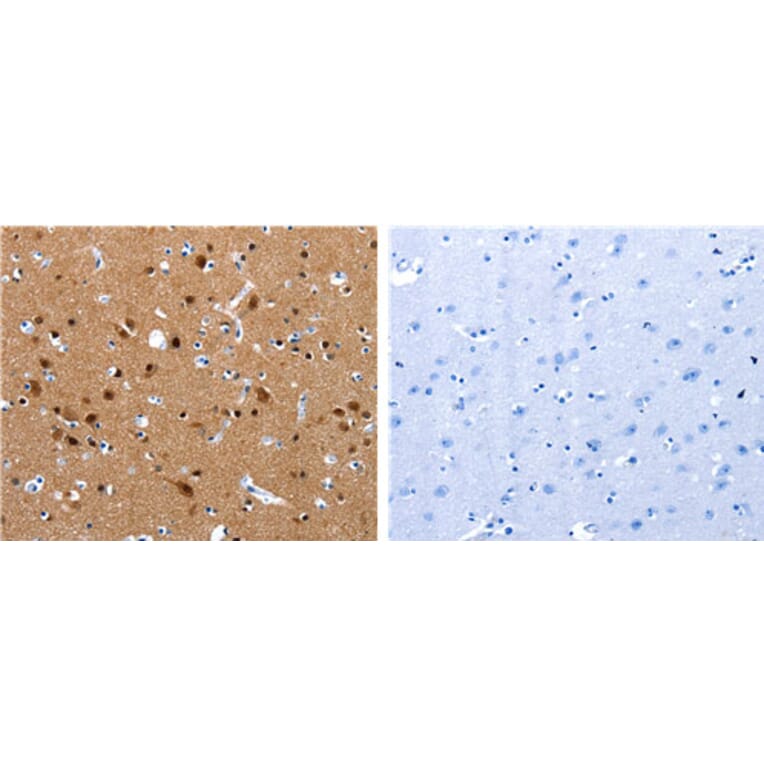 CRMP1 Antibody from Signalway Antibody (31173) - Antibodies.com