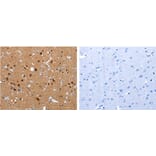 CRMP1 Antibody from Signalway Antibody (31173) - Antibodies.com