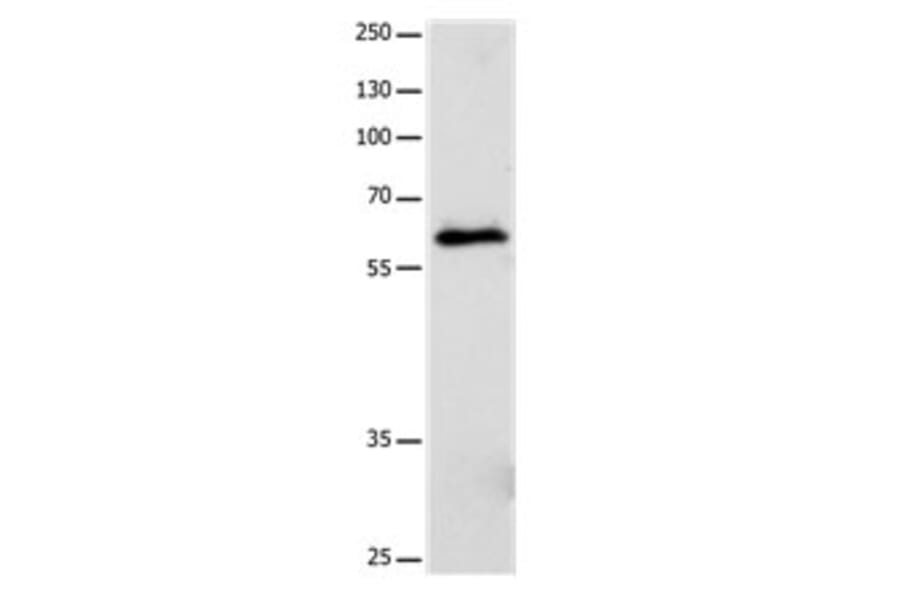 CRMP5 Antibody from Signalway Antibody (31174) - Antibodies.com
