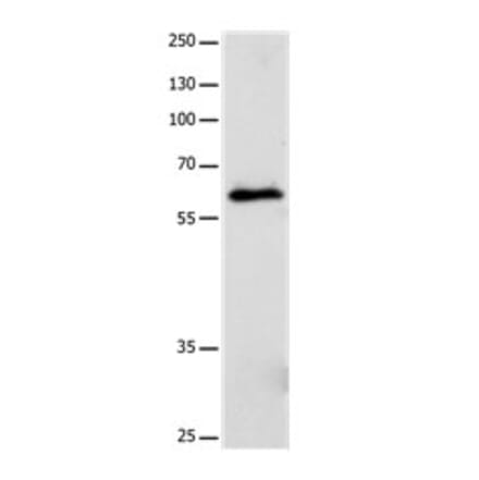 CRMP5 Antibody from Signalway Antibody (31174) - Antibodies.com