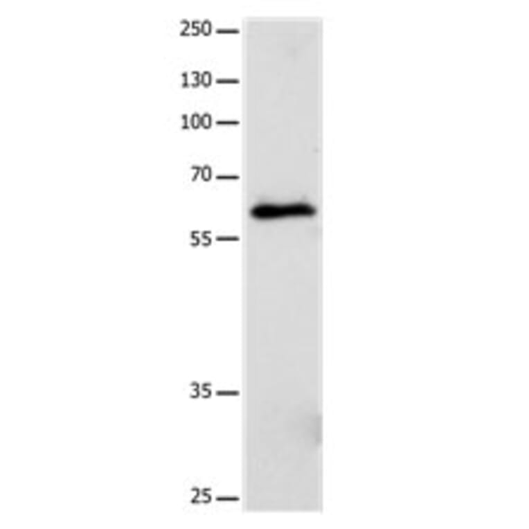 CRMP5 Antibody from Signalway Antibody (31174) - Antibodies.com