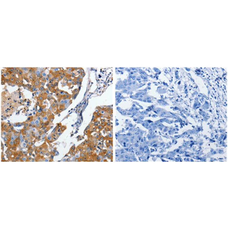 CRMP5 Antibody from Signalway Antibody (31174) - Antibodies.com