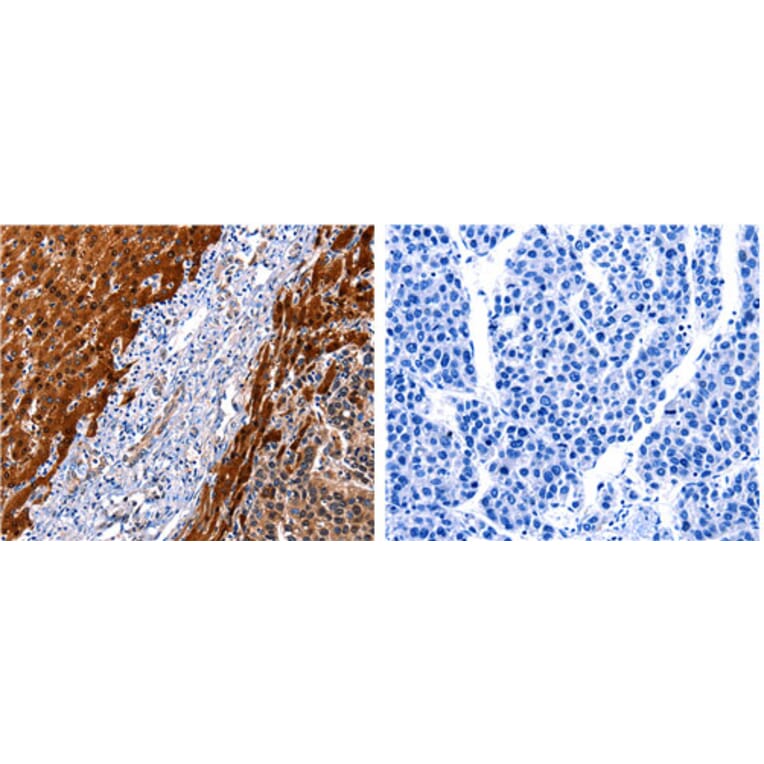 CUL4A Antibody from Signalway Antibody (31175) - Antibodies.com
