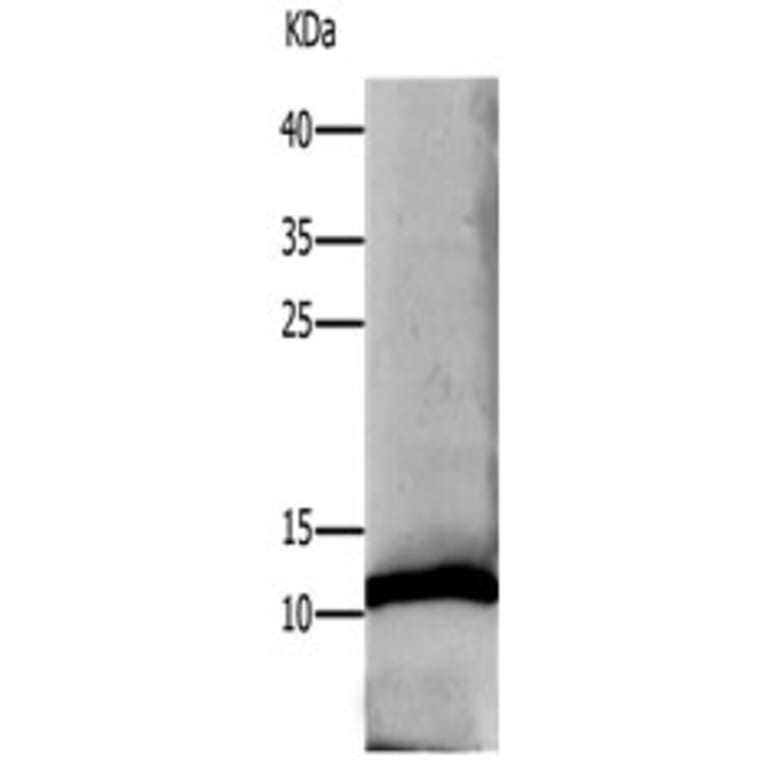 DEFA1 Antibody from Signalway Antibody (31183) - Antibodies.com