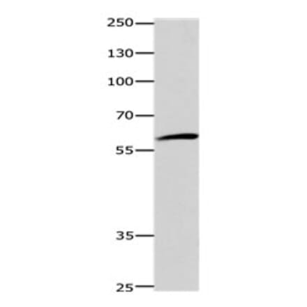 DISC1 Antibody from Signalway Antibody (31185) - Antibodies.com
