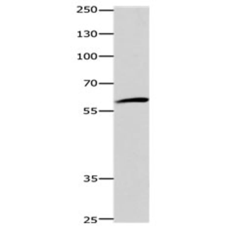 DISC1 Antibody from Signalway Antibody (31185) - Antibodies.com