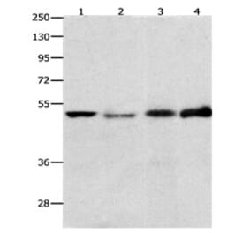 EDNRB Antibody from Signalway Antibody (31191) - Antibodies.com