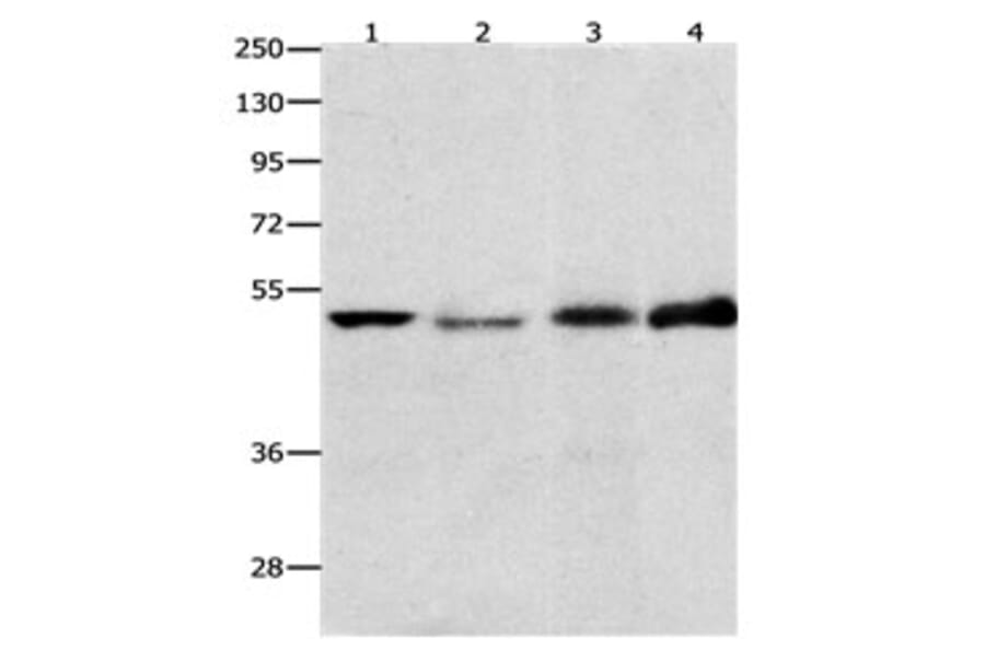 EDNRB Antibody from Signalway Antibody (31191) - Antibodies.com