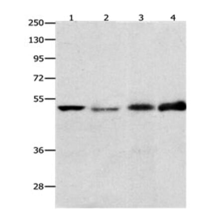 EDNRB Antibody from Signalway Antibody (31191) - Antibodies.com
