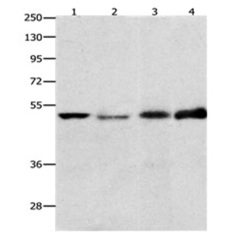 EDNRB Antibody from Signalway Antibody (31191) - Antibodies.com