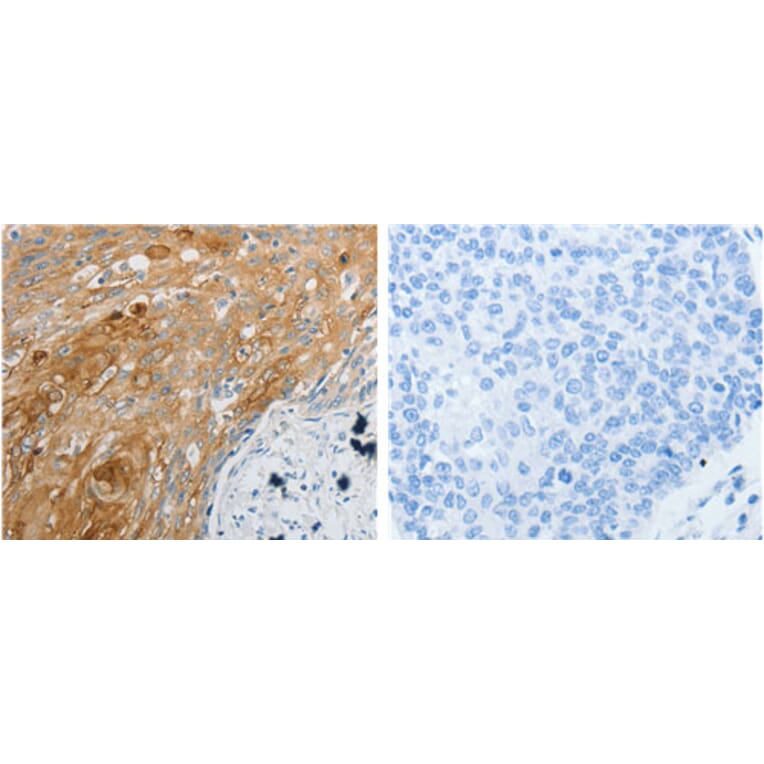 EDNRB Antibody from Signalway Antibody (31191) - Antibodies.com