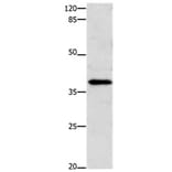 ENPP7 Antibody from Signalway Antibody (31192) - Antibodies.com