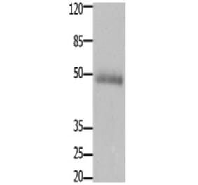 CCKBR Antibody from Signalway Antibody (31201) - Antibodies.com