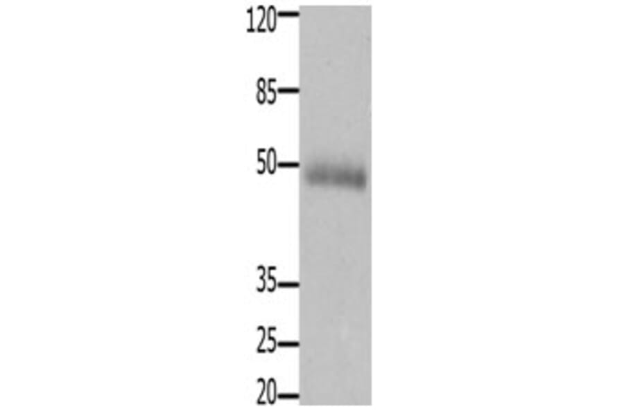 CCKBR Antibody from Signalway Antibody (31201) - Antibodies.com