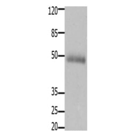 CCKBR Antibody from Signalway Antibody (31201) - Antibodies.com