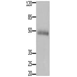 CCKBR Antibody from Signalway Antibody (31201) - Antibodies.com