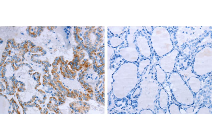 CCKBR Antibody from Signalway Antibody (31201) - Antibodies.com