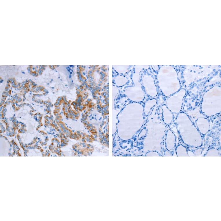 CCKBR Antibody from Signalway Antibody (31201) - Antibodies.com