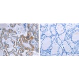 CCKBR Antibody from Signalway Antibody (31201) - Antibodies.com
