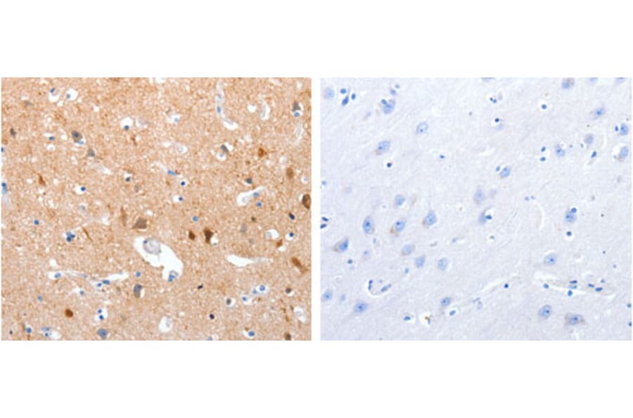 GPR6 Antibody from Signalway Antibody (31210) - Antibodies.com