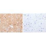 GPR6 Antibody from Signalway Antibody (31210) - Antibodies.com