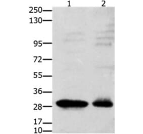 GNRHR Antibody from Signalway Antibody (31212) - Antibodies.com