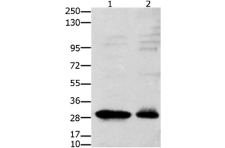 GNRHR Antibody from Signalway Antibody (31212) - Antibodies.com
