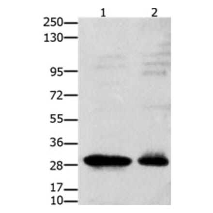 GNRHR Antibody from Signalway Antibody (31212) - Antibodies.com