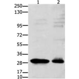 GNRHR Antibody from Signalway Antibody (31212) - Antibodies.com