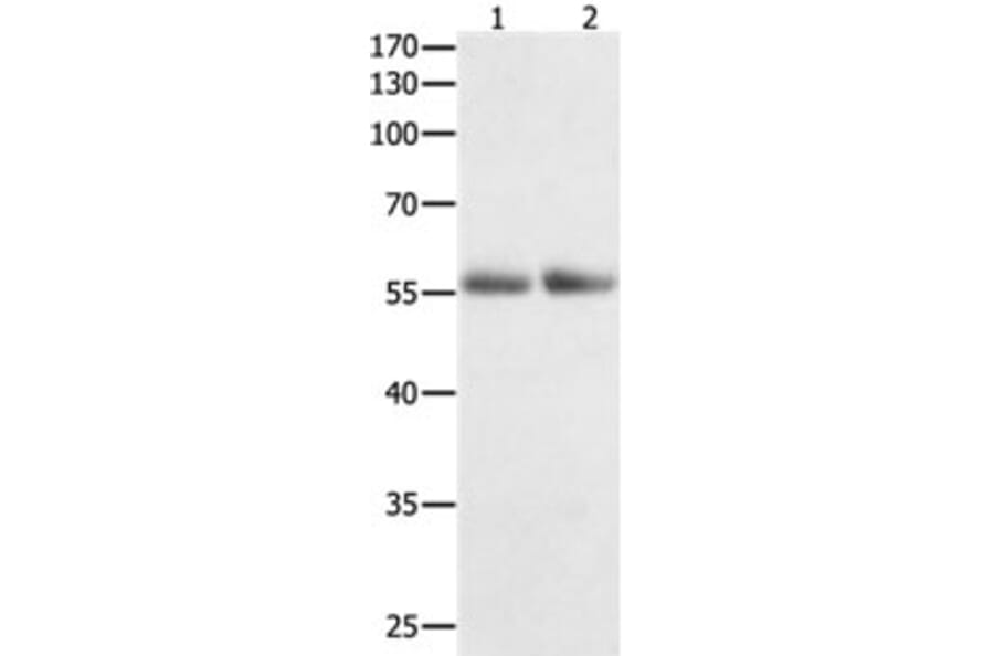 HDAC1 Antibody from Signalway Antibody (31215) - Antibodies.com