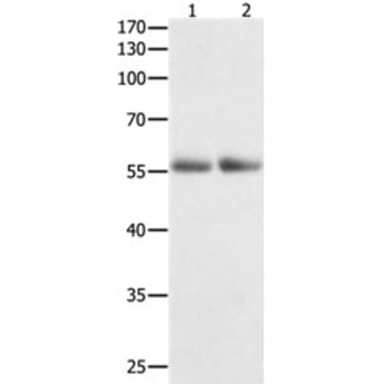 HDAC1 Antibody from Signalway Antibody (31215) - Antibodies.com