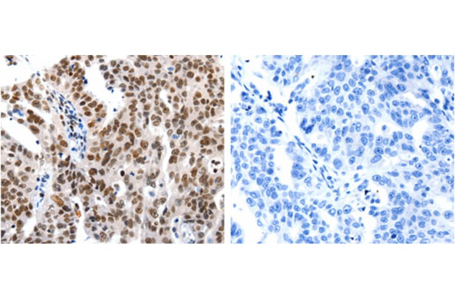 HDAC1 Antibody from Signalway Antibody (31215) - Antibodies.com