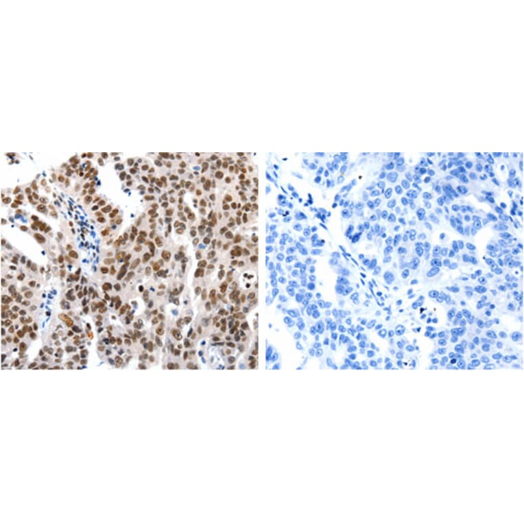 HDAC1 Antibody from Signalway Antibody (31215) - Antibodies.com