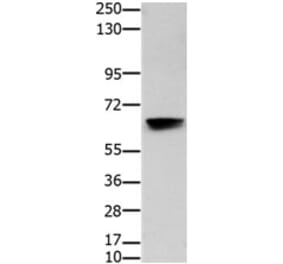 HDAC7 Antibody from Signalway Antibody (31217) - Antibodies.com